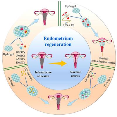 Application of Bioactive Hydrogels for Functional Treatment of Intrauterine Adhesion